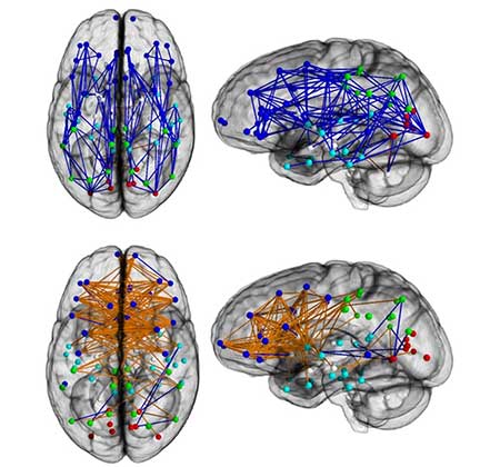 Donne E Uomini Differenze Di Cervello Per La Neuroscienza